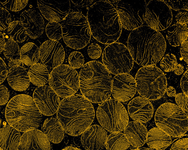 New clinical evidences confirm better muscle uptake in individuals after supplementation with coenzyme Q10 Phytosome™